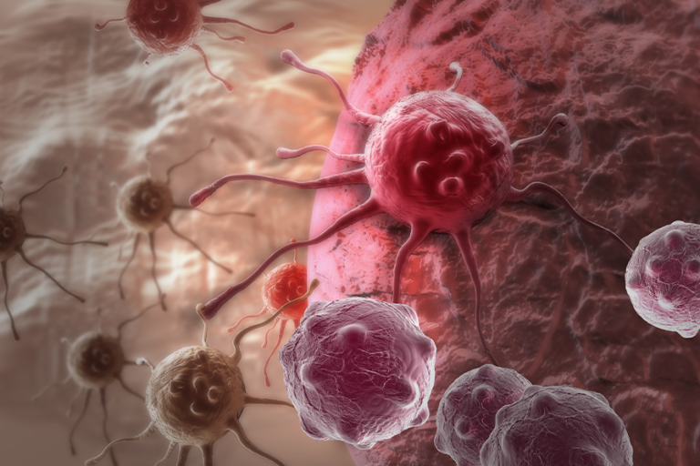 がん細胞は夜間にもっと活性化する？ こうした不快感は早期の警告かもしれない